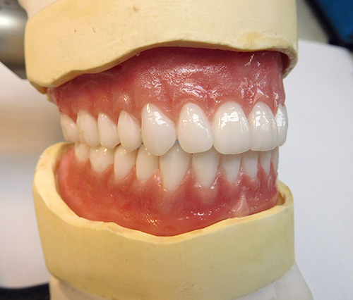 Denture_image_Dennis